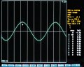 (cliccare) Fig. 2A: PERG standard ottenuto mediante stimolazione "steady state". Controllo.